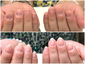 ジョワイユ(JOYEUX)の写真/【爪のお悩みなら当サロンへ！】資格保持者がお客様のお悩みに寄り添って施術をさせて頂きます。