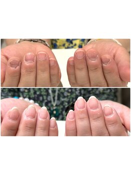 爪の悩みを解消できる（ケア含む）