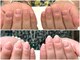 ジョワイユ(JOYEUX)の写真/【爪のお悩みなら当サロンへ！】資格保持者がお客様のお悩みに寄り添って施術をさせて頂きます。