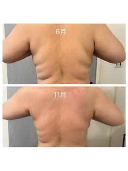 美温(mion)/痩身＆疲労回復