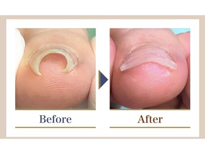 巻き爪補正店 越谷店の写真