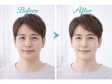 アプロ(Aphro)/若見えメンズフェイス