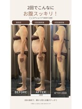 リラクゼーションサロン ラキ(laki)/インコアシェイプ