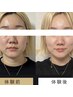 【小顔・たるみ】顔の筋トレ♪10月限定オープン記念価格☆通常￥16500→￥12800