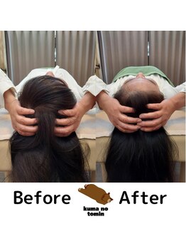 クマの冬眠 高知店/アタマほぐし