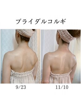 フロンテカリーナ(FRONTE CARINA)/ブライダルコルギ