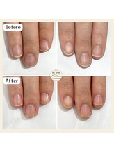 カロッス(Kallos)/ネイルケア