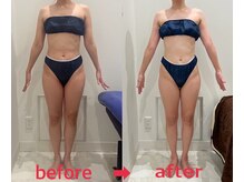 リンパを流すとほぐれるだけでなく、ボディラインが変わります！