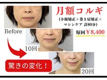 メディカルエステティックサロン リラックスイン(Relaxinn)/回数券の契約なし月謝で通える♪