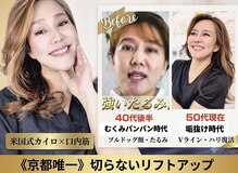サロンチオリ 烏丸(Salon Chiori)