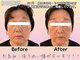 心晴。(コハル)の写真