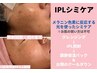 CMでも話題【IPL光シミケア美療】パッと明るくお顔全体くすみシミケア