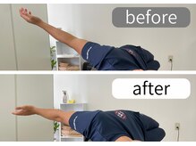 ナオル整体 大里院(NAORU整体)/20代　男性　肩ビフォーアフター