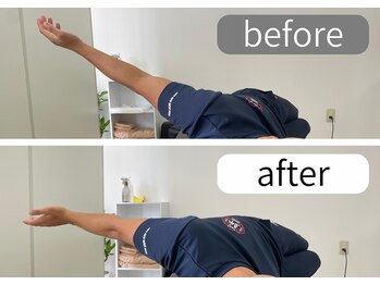 ナオル整体 大里院(NAORU整体)/20代 男性 肩ビフォーアフター