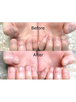 スカルプが得意なサロン