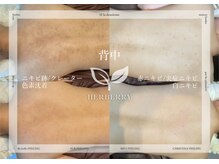 ハーバリー ハーブピーリング 大阪梅田店(HERBERRYハーブピーリング)の雰囲気（ハーブピーリングでニキビケア!シミシワケア!ほうれい線毛穴洗浄）