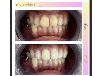 エクシアホワイト 北24条駅前店/