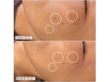 オハダ(ohada)の雰囲気（シミ改善/あらゆるお悩みにも対応）