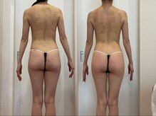 オリーブ(Olive)/120分コースのビフォーアフター