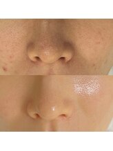 ナニロア(nani loa)/イチオシのセラピール♪