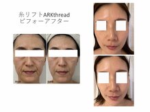 ルミナスパリジェンヌ 甲府店の雰囲気（女神降臨！シミしわ美白！純度100%3倍の高濃度神経幹細胞！）