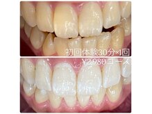 ホワイトニングルーム 横浜店(Whitening Room)/セルフホワイトニング/横浜