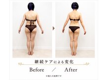 サロン ド ルポスの雰囲気(顔も身体も合わせたマシン×ハンドのオーダーメイドケア)