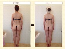 カロン(Kalon)/痩身