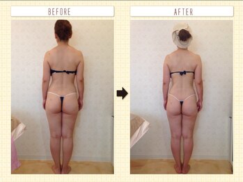 カロン(Kalon)/痩身