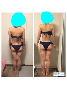 セルビューティー(Cell Beauty)/30代、筋膜リリース全身10回