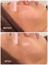 ククル(KUKULU)/ハーブ 6回目♪（50代女性）