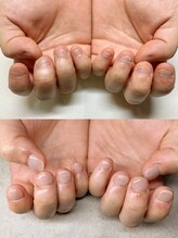 ナナネイル(7.Nail)/噛み爪のサポート