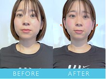 ビューティーマジック 恵比寿 広尾(beauty magic)の雰囲気（究極の小顔矯正術で小顔美人に！《小顔矯正/美容整体/恵比寿》）