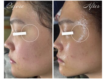 サラスヴァティー(SARASVATI)/毛穴をキュッと引締め★20代女性