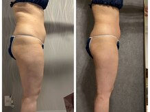 フュース(Futh)/全身サイズダウン/ダイエット