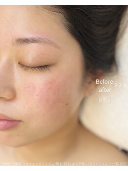 エリス(ELISSE)/眉毛はサロンで整える時代