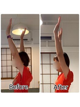 チェルシーストレッチ整体院/上がらない腕は肩こりの原因