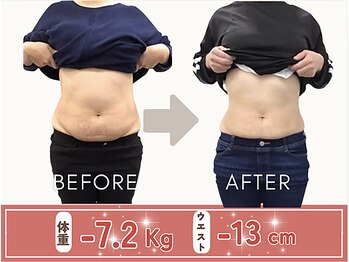 たどころ整骨院/産後骨盤矯正ダイエットの結果！