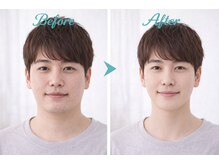 アプロ(Aphro)/清潔感アップ変化