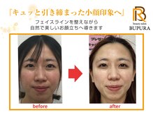 ブプラ つくば店(BUPURA)/before→after　８
