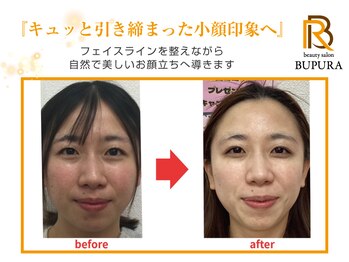 ブプラ つくば店(BUPURA)/before→after　８