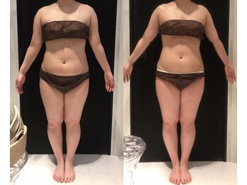 リボディ 表参道(An re Body)/before→after