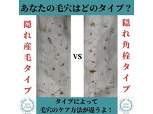 プラスボーテ 幡ヶ谷(plus beaute)/結果が見える毛穴ケア