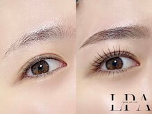 レピア 高槻店/韓国式LEPIA Before&Aｆter