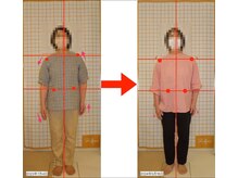 リファイン(Refine)/股関節の痛みや前ももの重だるさ