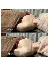 リノレア(LinoLea)/バストアップBefore after