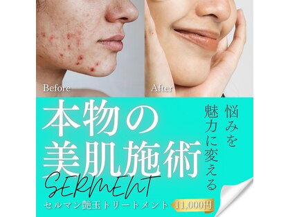 エーケーエステティックス 熊本新市街店(AK Esthetics)の写真