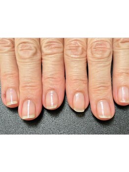 爪の悩みを解消できる（ケア含む）