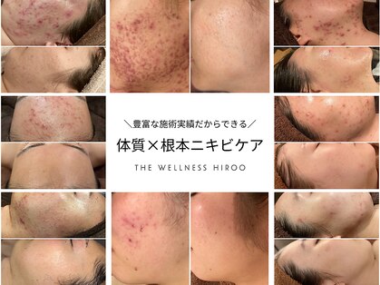 ザ ウエルネス ヒロオ(THE WELLNESS HIROO)の写真
