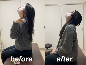 タケダ整体院/噛みしめも肩こりの原因に！？